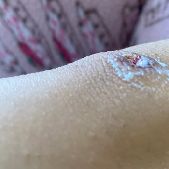 Suit Güzellik Merkezleri Kayseri Süit Güzellik Merkezi