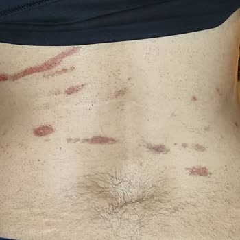 Enza Güzellik Merkezleri Ankara'daki Güzellik Merkezi Şikayeti