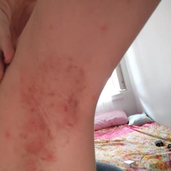 Celenes By Sweden Celenes Deodorant Şikayet