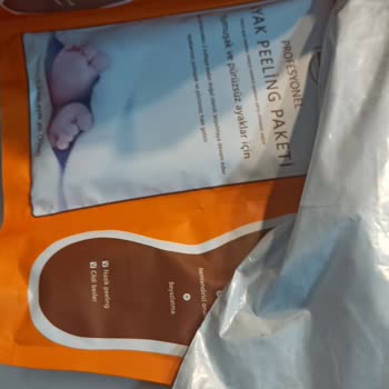 Trendyol Eksik Gelen Ürün Ve Kargo Problemleri
