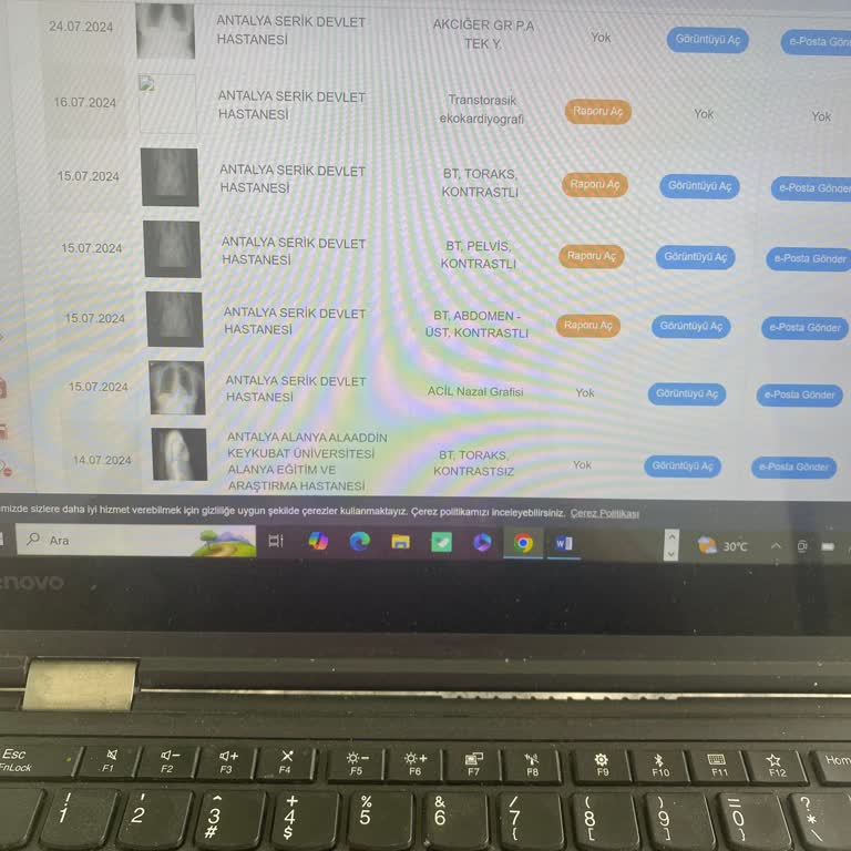 Seven Seas Palmeras Bay'da Ölümüne İhmalkarlık