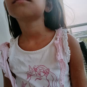 Özel Beyaz Altın Ağız Ve Diş Sağlığı Polikliniği (Söke) Acil Apseli Dişe Randevu Talebi