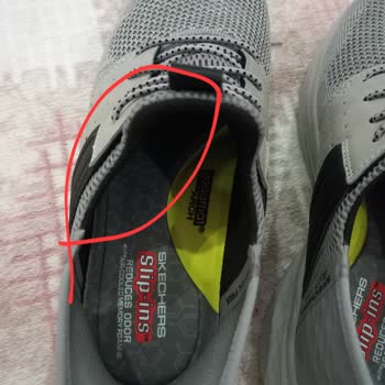 Skechers Defalarca Uyarmama Rağmen Yine Defolu Ürün Gönderildi