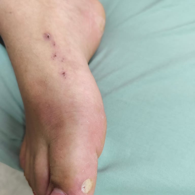 Bambi Ayakkabı Müşteri Hizmetlerinde Yetersizlik Ve Ürün İade Sorunu