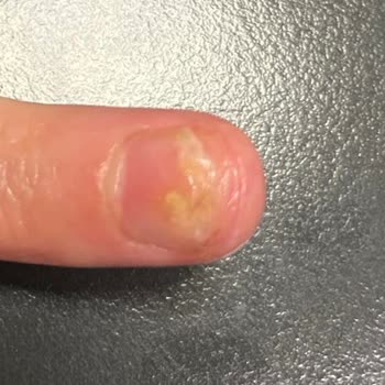 Eylül Öztürk Maltepe Şubesi'nde Acılı Ve Kalitesiz Manikür Deneyimi