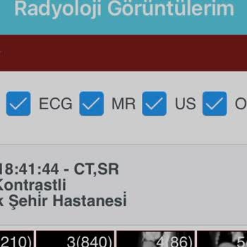 Ankara Etlik Şehir Hastanesi Tomografi Rapor Yazılmadı