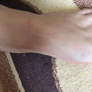 Ceyo Marka Terlik Ayaklarımı Mahvetti