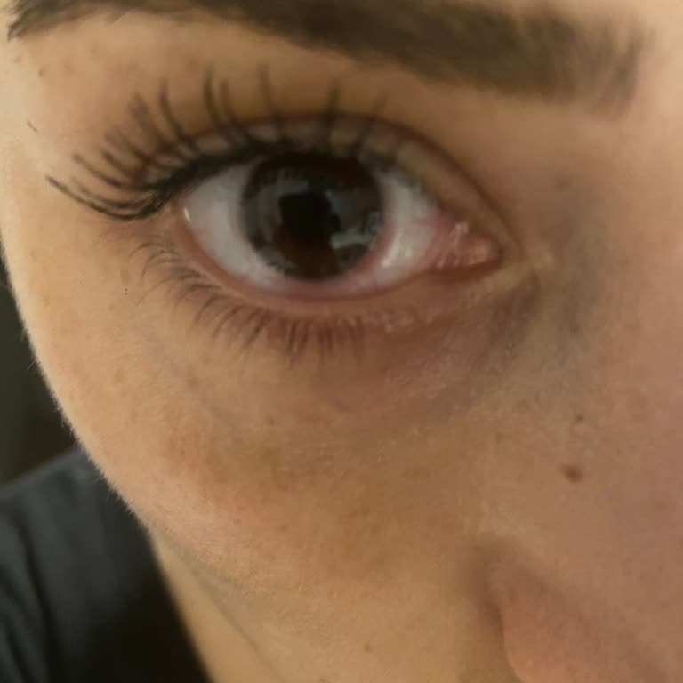 Atasun Optik Yüzünden Gözümden Oluyordum!