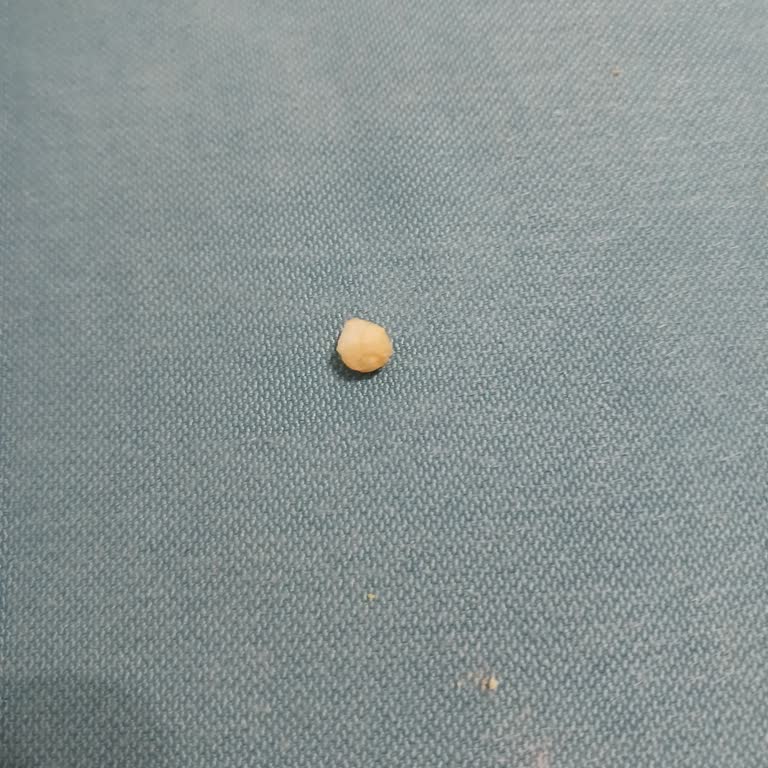 Yemeksepeti Burger King'den Çıkan Kemik Parçası
