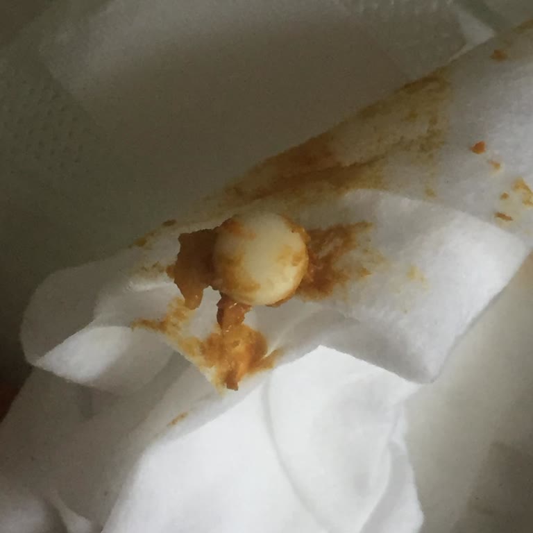 Abdi İbrahim İlaç Hatası Olabilir Mi?