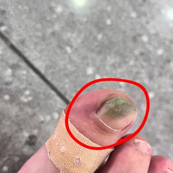 Adidas'tan Aldığım Ayakkabı 5 Ayda Çöp Oldu Adidas Pişmanlık