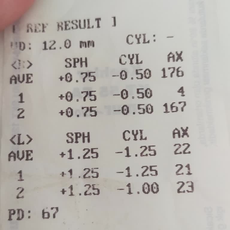 Maya Göz Hastanesi Kayseri Kayseri Maya Göz Smile Lazeri Şikayeti