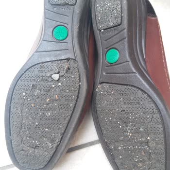 Forelli Üzdü. Bir Sefer Giydiğim Ayakkabının Altı Parçalandı