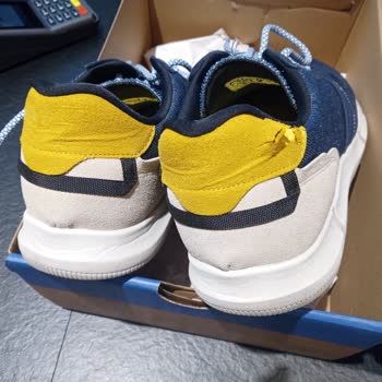 Deichmann Ayakkabısı Pul Pul Döküldü