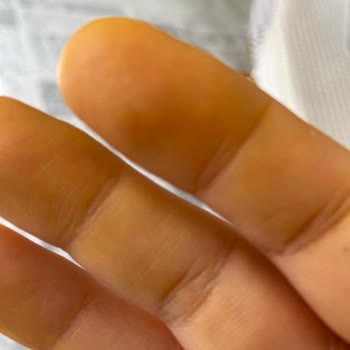 Tereson Sprey Hakkında Fikrimiz