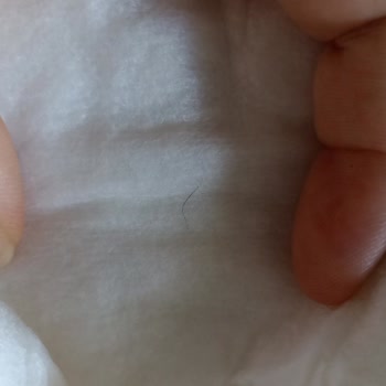 Sleepy Sleep Bebek Bezinin İçinden Kıl Cıktı