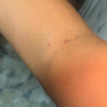 Şişli Kolan Hastanesi Kan Alamıyor Travma Yaşatıyor