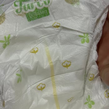 Baby Turco Bebek Bezi Yabancı Madde
