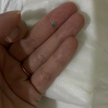 Baby Turco Bebek Bezi Yabancı Madde