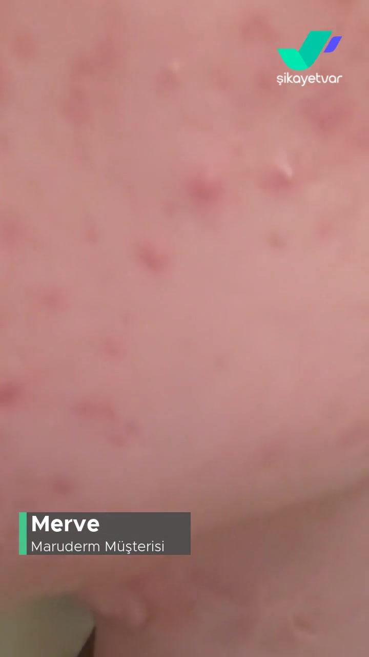 Maruderm Yüz Temizleme Jeli Ve Güneş Kremi Sıkıntısı! videonun kapak resmi