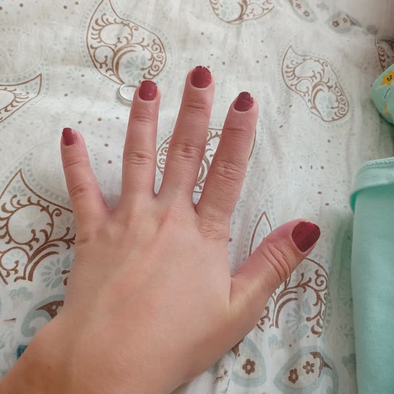 Tereson Ellerim Şişti Karıncalandı