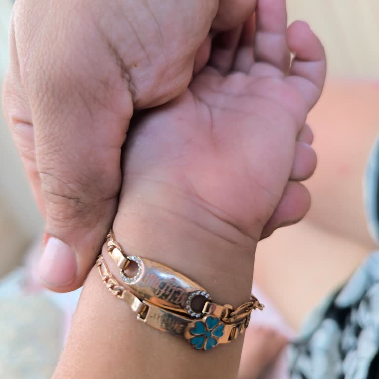 Grimni Accessories Ürünlerinde Renk Değişimi Ve Müşteri Memnuniyetsizliği