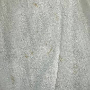 Yeni Alınan Beko Marka Çamaşır Makinesinde Sarı Leke Problemi
