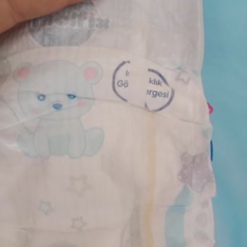 Molfix Bebek Bezlerinde Kalite Sorunu!