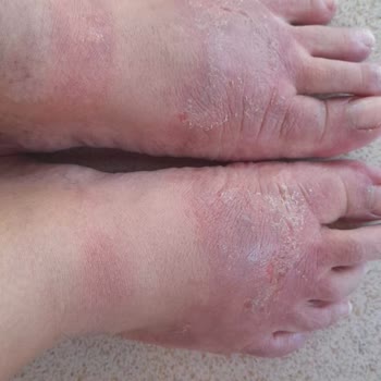 LCW Sandalet Şikayeti