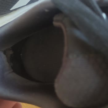 Adidas Kısa Sürede Ayakkabı Yırtıldı Ve İlgilenmediler!