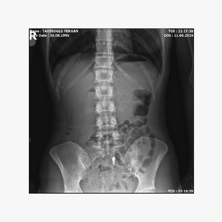 Allianz Sigorta Özel Sağlık Sigorta Acil'deki İşlemleri Karşılamadı