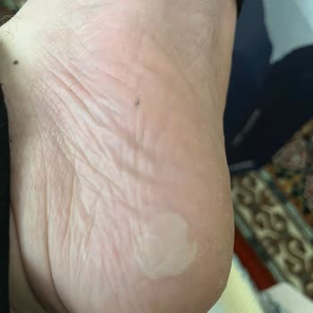 Skechers Marka Ayakkabı Alacaklar Dikkat!