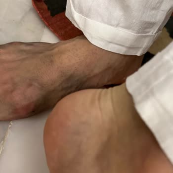 Deichmann' Dan Aldığım Terlikler Ayağımı Yara Yaptı Boya Döküyor