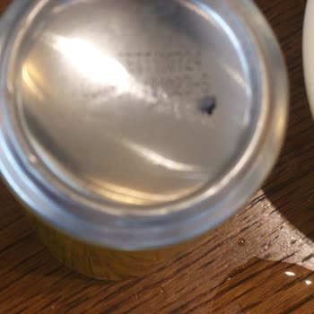 Dönerci Serkan Usta Sağlık Ve Güvenlik Endişeleri: Acil Müdahale Gerekiyor