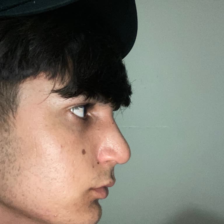 Ataköy Hastanesi Burun Ameliyatı Şikayeti