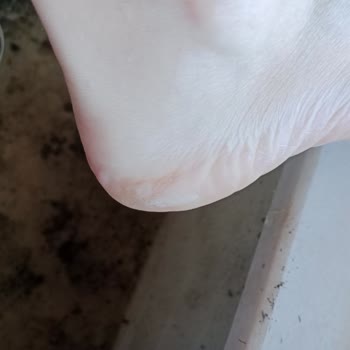 Asics Koşu Ayakkabı Şikayeti
