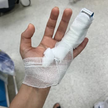 Çakmak Erdem Hastanesi'nde Yetersiz Sargı Uygulaması Ve İlgisizlik