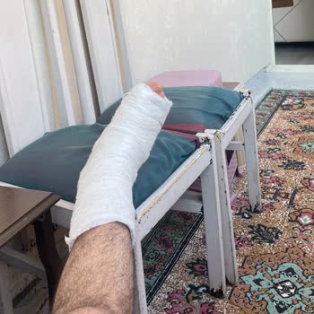 Ağrı Devlet Hastanesi Ağrı Eğitim Araştırma Hastanesi Ortopedi Servisi Hastaya Bakmama