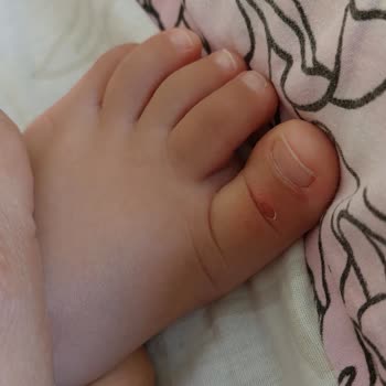 Vicco Sandaletlerde Yaşanan Sorunlar Ve Müşteri Hizmetleri Deneyimi