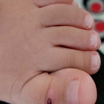 Vicco Sandaletlerde Yaşanan Sorunlar Ve Müşteri Hizmetleri Deneyimi