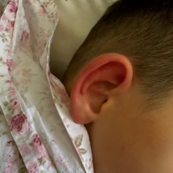 Argivit Smart'tan Kaynaklı Alerji