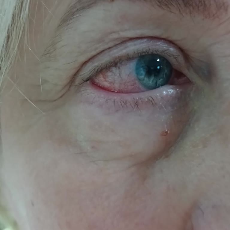 Özel Sevgi Hastanesi (Balıkesir) Hastane Deneyimi Ve Tedavi Süreci Üzerine Görüşler