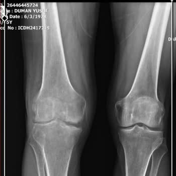 Sağlık Bakanlığı Seni 15 Dakika Rahatlatıp Deyip, Paramla Sakat Bıraktı