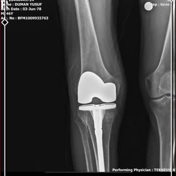 Sağlık Bakanlığı Seni 15 Dakika Rahatlatıp Deyip, Paramla Sakat Bıraktı
