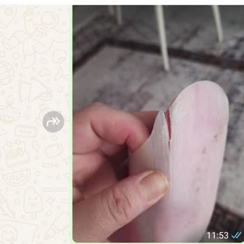 Trakya Ortopedi (trakyaortezprotez) Çorlu Kalitesiz Hizmet