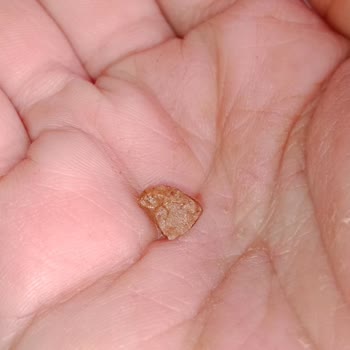 Hamza Efendi Tatlıdan Taş Çıktı!