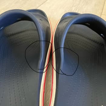 Crocs Terlik & Ayakkabı Crocs Terliği Ayağımı Yara Yaptı, İade Talep Ediyorum!