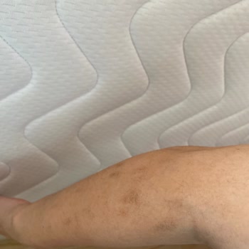 Riomi Hnk Teknoloji Lazer Epilasyon Aleti İade İşlemi