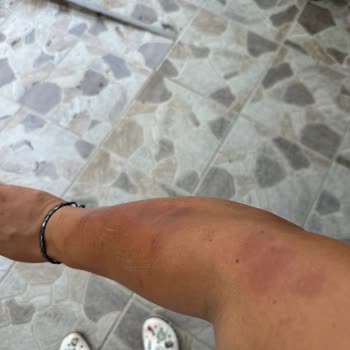 Meliderm Estetik ve Güzellik Meliderm Luxury Güzellik Merkezi