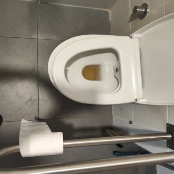 Etlik Şehir Hastanesi KBB Bölümü Hijyen Ve Personel Şikayeti